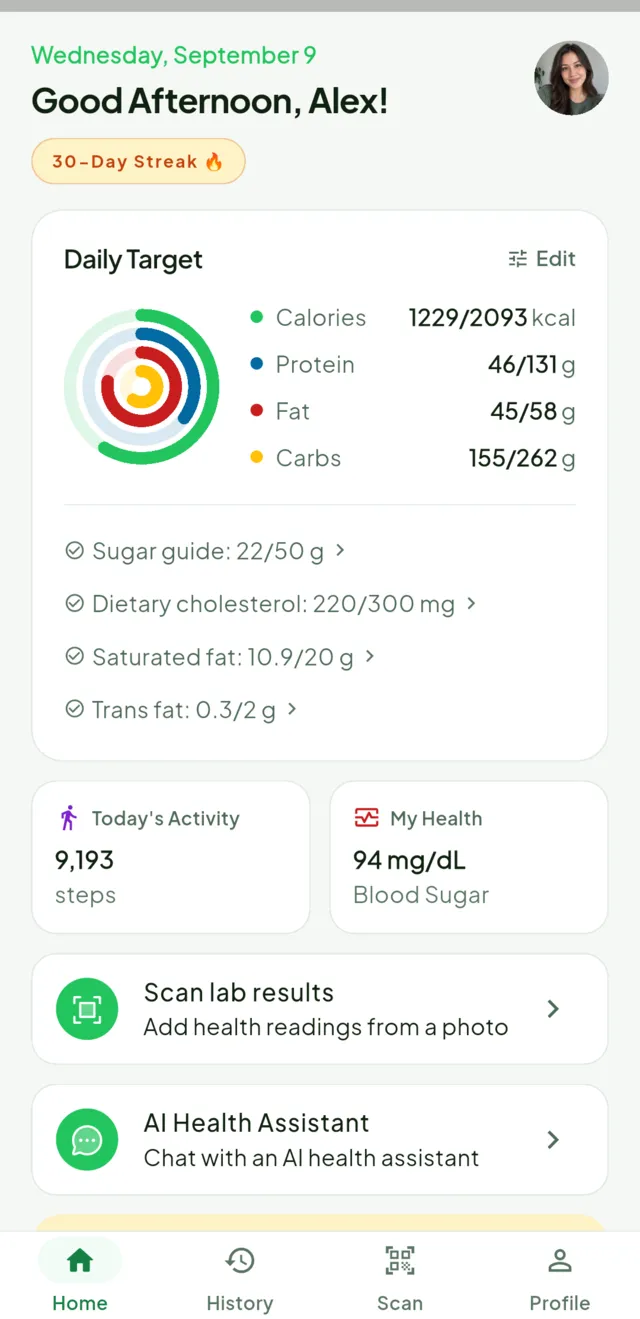 The Senumi home screen: a daily target ring showing calories, protein, fat and carbohydrates against goals, today's step count, a recent blood-sugar reading, and shortcuts to lab-result scanning and the AI Health Assistant.